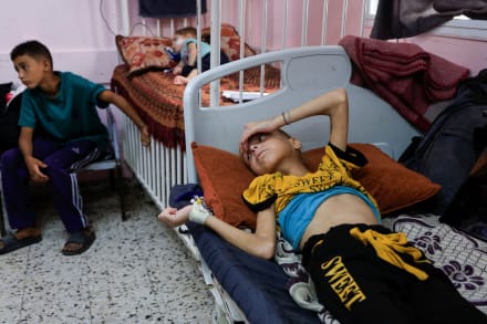 En palæstinensisk pige modtager behandling for underernæring på Nasser Hospital i Khan Younis i Gaza.