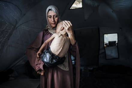 Muhammad Zakariya Ayyoub al-Matouq på halvandet år i armene på sin mor i juli i et telt i Gaza. Udover at have en underliggende sygdom er han også stærkt underernæret.