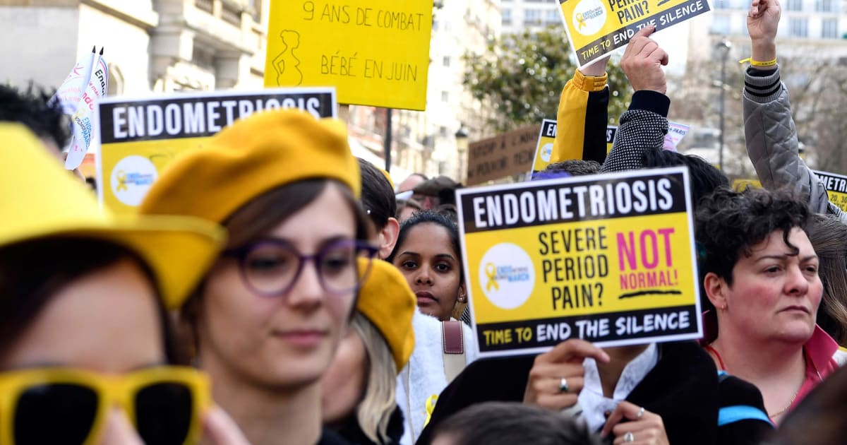 Endometriose: Hvorfor Kvinderes Smerter Ignoreres – Og Hvad Det Koster Samfundet