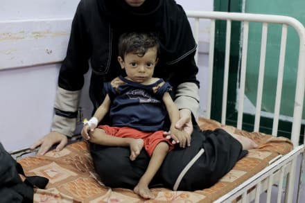 Underernærede børn modtager behandling på hospital ved Deir al-Balah syd for Gaza By.